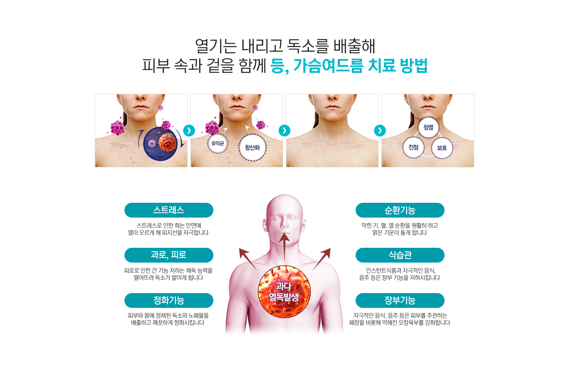 등,가슴여드름 원인